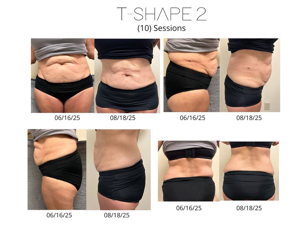 10 Sessions Corning Wellness