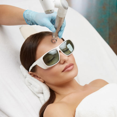 Laser Treatment